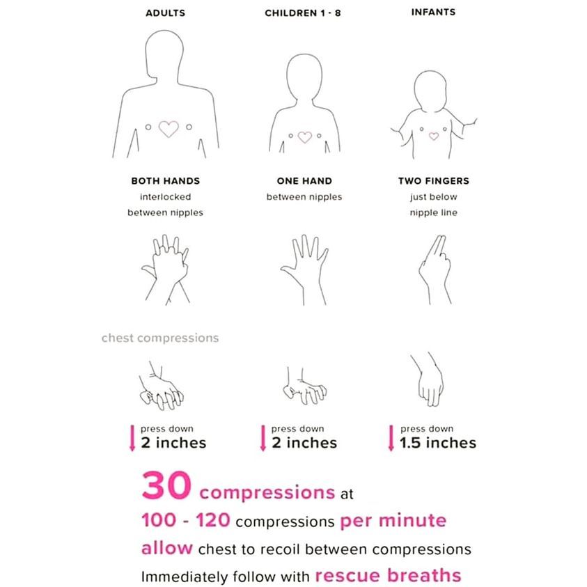 Joint Compression Handout.pdf Education page